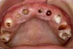 Child Dentistry, Child Dentistry In Delhi