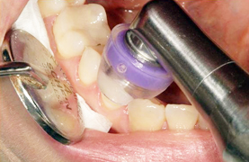 Heal Ozone Treatment in delhi