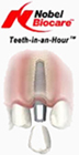 Teeth in an hour-BOI, Teeth in an Hour, Teeth in an Hour dental clinic in delhi