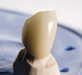 CAD-CAM based crowns, veneers, inlays – onlays to your clinic in 4 hour’s time