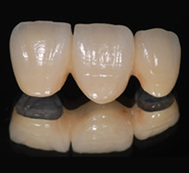 Dental Laboratory in Delhi, Dental Lab in delhi