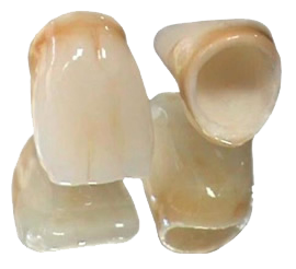 Dental Lab, Dental Laboratory in Delhi, Dental Lab in delhi, Dental Lab In South Delhi